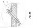 Fig. 05 - Cardiac output measurement devices and methods