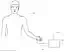 Fig. 01 - Cardiac output measurement devices and methods