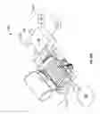 Fig. 16 - Method and apparatus for penetrating tissue