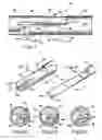 Fig. 03 - Medical catheters and methods