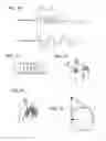 Fig. 09 - Massaging device having a controller to give different reciprocating movements to each applicator along different axes