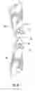 Fig. 09 - Edge binding for orthopedic supports and method of using same