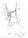 Fig. 04 - Fastener tabs and strapping system for orthopedic supports and method of using same