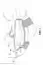Fig. 02 - Dynamically adjustable joint extension and flexion device