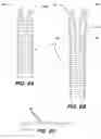 Fig. 06 - Dynamically adjustable joint extension and flexion device