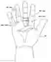Fig. 01 - Digit pad and method for treating trigger finger and trigger thumb