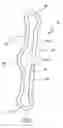 Fig. 02 - Methods and devices for tensioning a wrap around a blood vessel