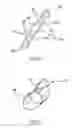 Fig. 06 - Methods and devices for tensioning a wrap around a blood vessel