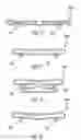 Fig. 07 - Methods and devices for tensioning a wrap around a blood vessel