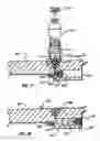 Fig. 09 - Needle free hypodermic injector and ampule for intradermal, subcutaneous and intramuscular injection