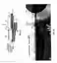 Fig. 12 - Needle free hypodermic injector and ampule for intradermal, subcutaneous and intramuscular injection
