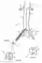 Fig. 02 - VASCULAR SHEATH WITH VARIABLE LUMEN CONSTRUCTION