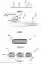 Fig. 07 - VASCULAR SHEATH WITH VARIABLE LUMEN CONSTRUCTION