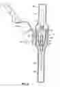 Fig. 03 - Flashback blood collection needle with needle shield