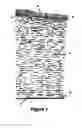 Fig. 02 - METHODS AND COMPOSITIONS FOR OPTIMIZING THE OUTCOMES OF REFRACTIVE LASER SURGERY OF THE CORNEA