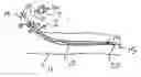 Fig. 01 - Endovascular method and apparatus with electrical feedback