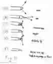 Fig. 03 - Endovascular method and apparatus with electrical feedback