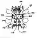 Fig. 01 - Spinal stabilization device