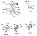 Fig. 02 - Spinal stabilization device
