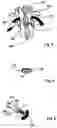 Fig. 04 - Spinal stabilization device