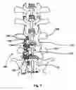 Fig. 07 - Spinal stabilization device