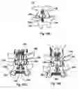 Fig. 10 - Spinal stabilization device