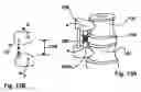 Fig. 13 - Spinal stabilization device