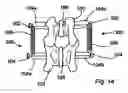 Fig. 14 - Spinal stabilization device
