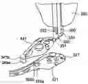 Fig. 01 - Targeting device for orthopedic implants