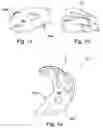 Fig. 03 - Targeting device for orthopedic implants