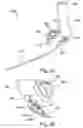 Fig. 04 - Targeting device for orthopedic implants