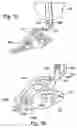 Fig. 07 - Targeting device for orthopedic implants