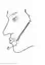 Fig. 01 - Surgical thread and cosmetic surgery method