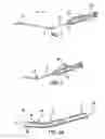 Fig. 02 - Articulating suturing device and method