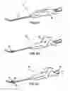 Fig. 03 - Articulating suturing device and method