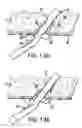 Fig. 14 - Articulating suturing device and method