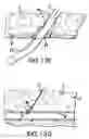 Fig. 15 - Articulating suturing device and method