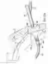 Fig. 25 - Articulating suturing device and method