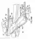 Fig. 29 - Articulating suturing device and method