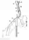 Fig. 32 - Articulating suturing device and method