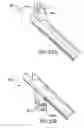 Fig. 36 - Articulating suturing device and method