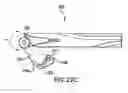 Fig. 37 - Articulating suturing device and method