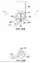 Fig. 44 - Articulating suturing device and method
