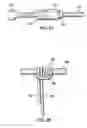 Fig. 46 - Articulating suturing device and method