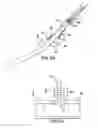 Fig. 47 - Articulating suturing device and method