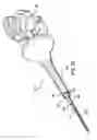 Fig. 51 - Articulating suturing device and method