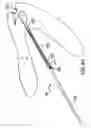 Fig. 59 - Articulating suturing device and method