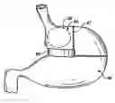 Fig. 01 - Methods and devices for maintaining a space occupying device in a relatively fixed location within a stomach