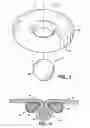Fig. 03 - Methods and devices for maintaining a space occupying device in a relatively fixed location within a stomach
