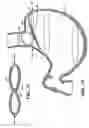 Fig. 07 - Methods and devices for maintaining a space occupying device in a relatively fixed location within a stomach